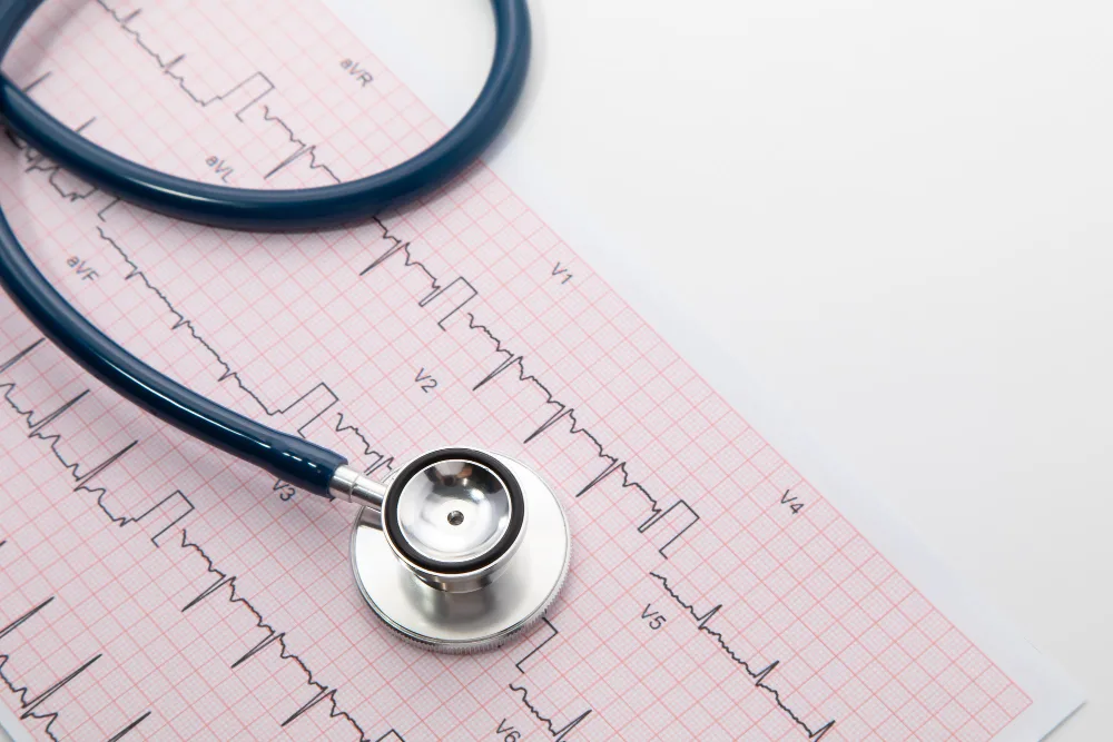 Electrocardiograma como parte de la evaluación médica integral